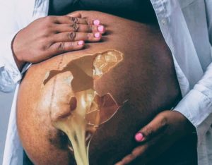 Article : Avortement : « fetuses lives matter » – la vie des fœtus compte –